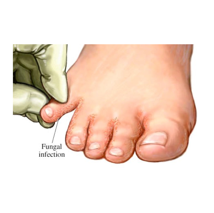 CUREIX SYSTEM – BANDI NAILS